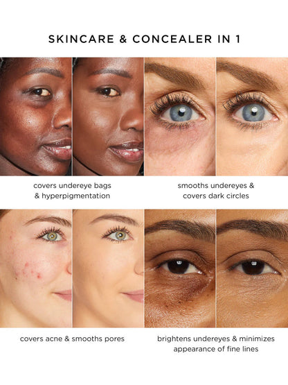 🔥 💥Under-Eye Bags? Dark Spots? This Diamond-Tip Concealer Stick Hugs Contours for Flawless Coverage.