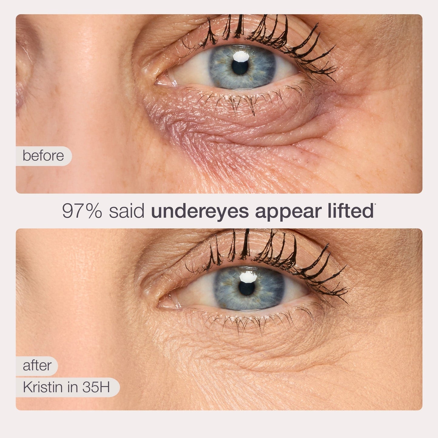 🔥 💥Under-Eye Bags? Dark Spots? This Diamond-Tip Concealer Stick Hugs Contours for Flawless Coverage.