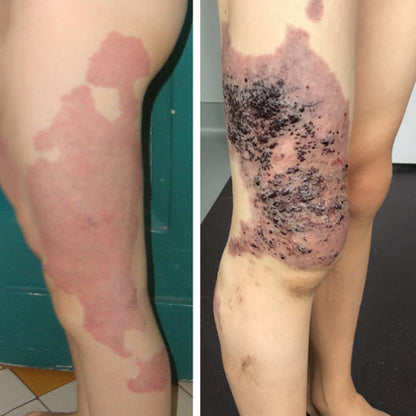 Medazy® HoneyShield Barrier Repair Cream