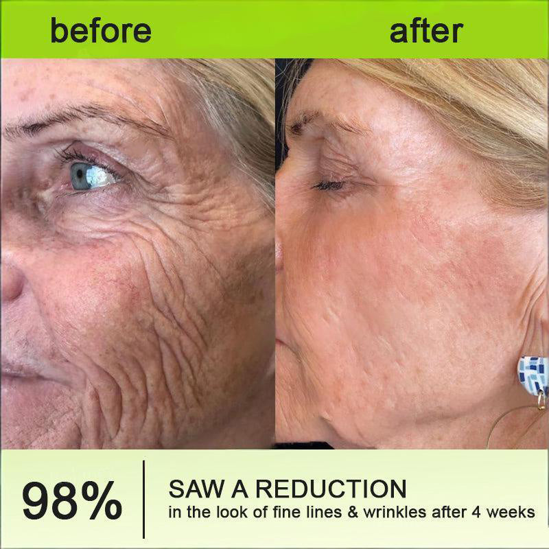 🧠👨‍⚕️Made and shipped from the USA 💫Lovilds® Botin & Vita-A Retinol Shot Wrinkle-Lift Tightening cream - Last Day Promotion 50% OFF