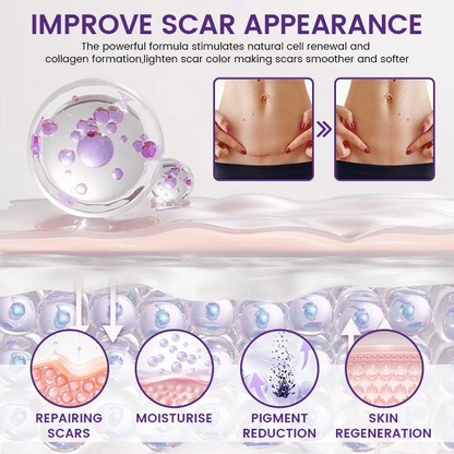 Medazy® ReGenScar Stem Cell Scar Gel