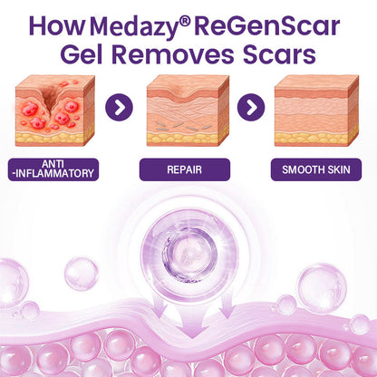 Medazy® ReGenScar Stem Cell Scar Gel