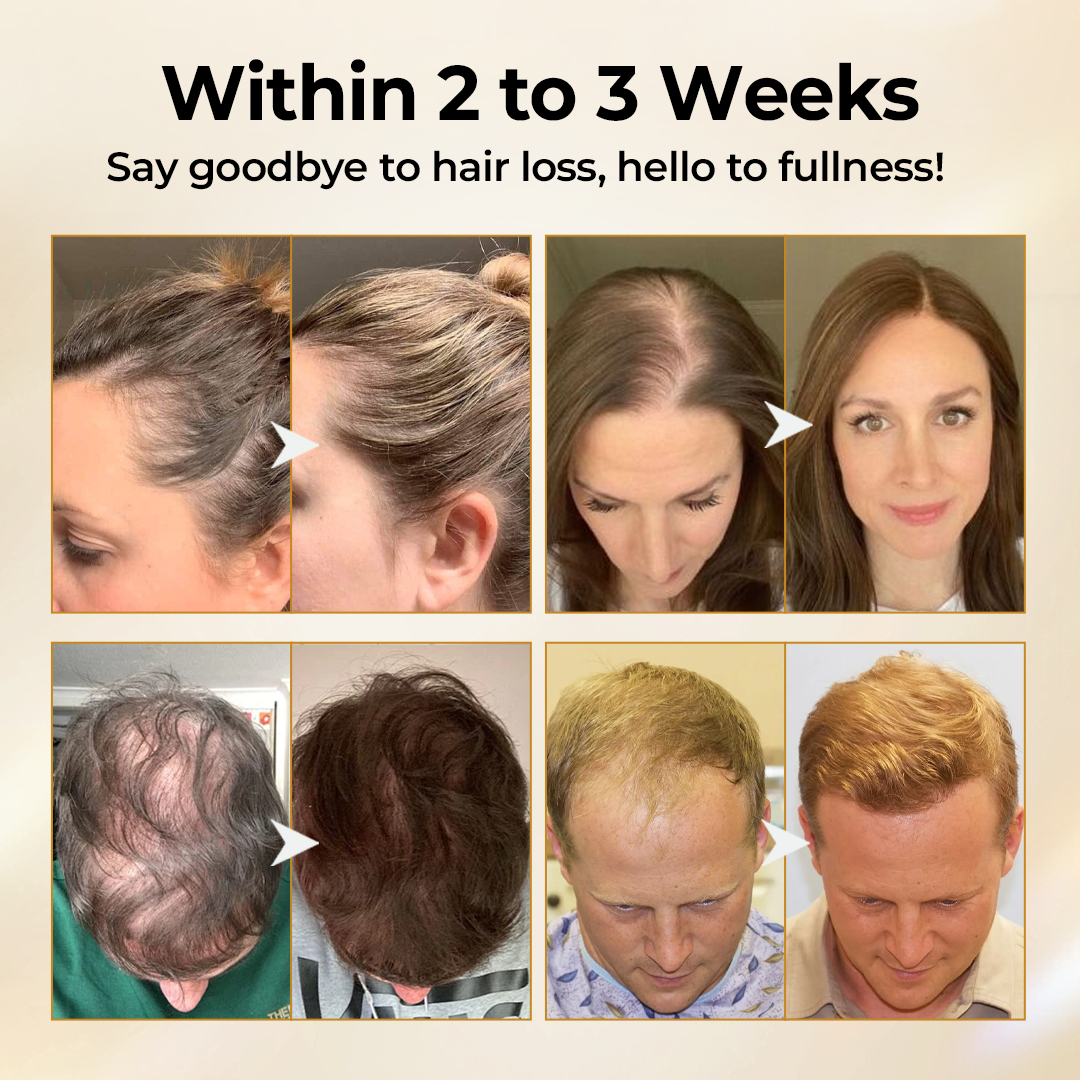 Diystar® CollagenGrow Peptides Hair Growth Spray