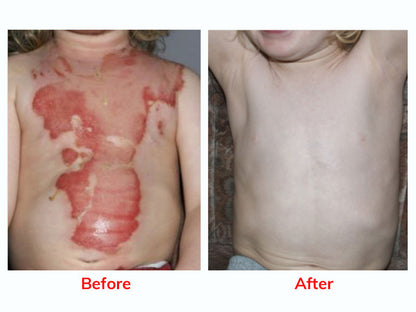 Medazy® HoneyShield Barrier Repair Cream