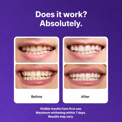 Instant purple tone-correcting strips that help improve the look of yellow tones in minutes — no peroxide, gentle formula