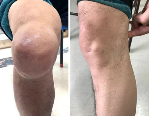 Diystar® Silver Ion Joint Repair Spray